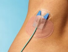 Drain Guard Fikseringsplaster CH5-16 steril