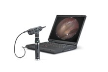 Digitalt MacroView otoskop