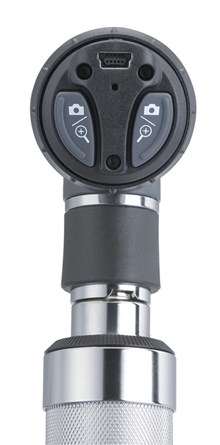 Digitalt MacroView otoskop