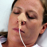 NasoGastric Tubeholder Ernæringsslange