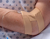 IV-ARMOR, Fleksibel beskyttende bandasje