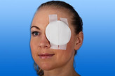 NOBALUMENAL® Steril Øyekomp 54x70mm