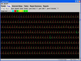 Ekg Holter LX Enhanced programvare